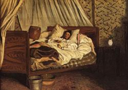 Frederic Bazille The Improvised Field-Hospital oil painting picture